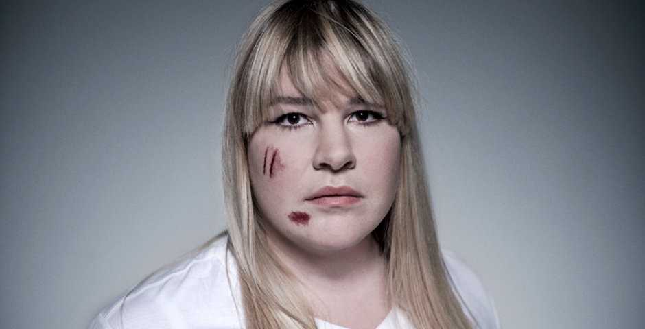 Nominee - Hurts Me Too